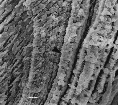 Fig.  11.