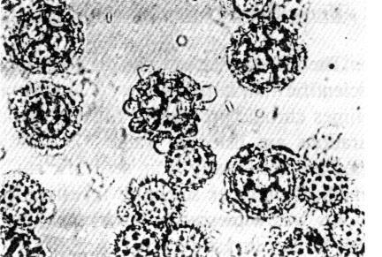 Vernonia perotteti gr. (large) and Synedrella gr (small, spiny) from honey in Malawi