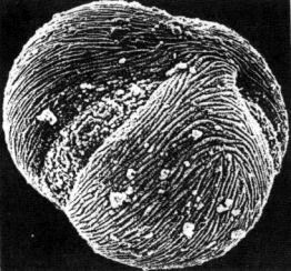 Acerplantanoides (SEM, approx. 2600x)