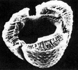 Centaurea cyanus (freeze sectioned, SEM approx 2400x) showing thick pollen wall)