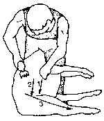 Figure 4.1 Merino shearing pattern