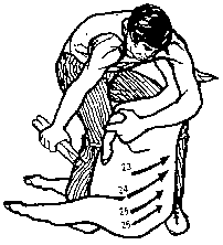 Figure 4.5 Blade shearing