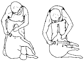 Figure 4.2 Machine shearing crossbred sheep